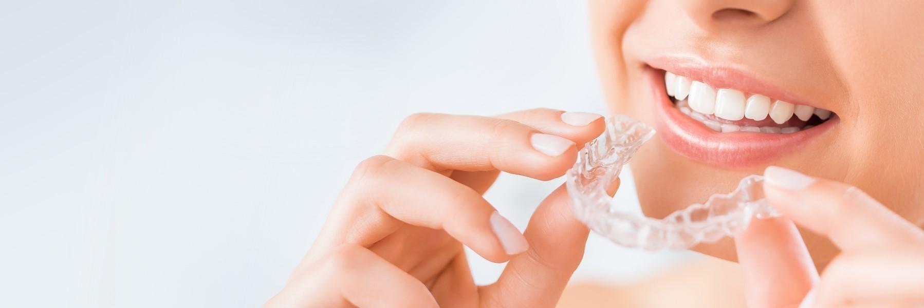 Adult Orthodontics | Dentist