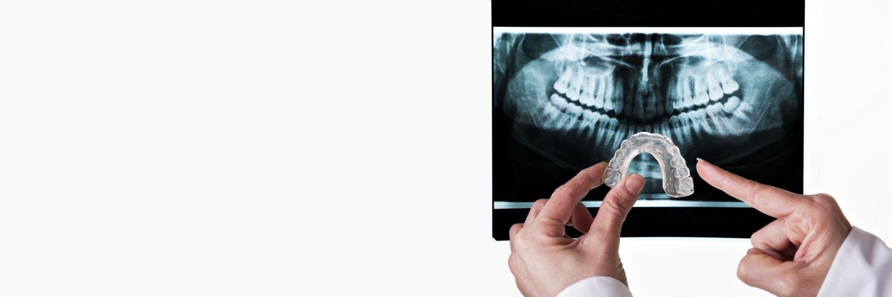 Occlusal Splints & Night Guards | Dentist